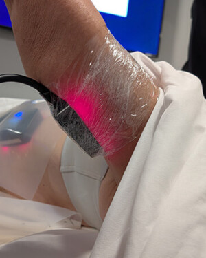 NuSHAPE 11N is non-invasive, with each stimulation mode resting gently on the targeted area of treatment.